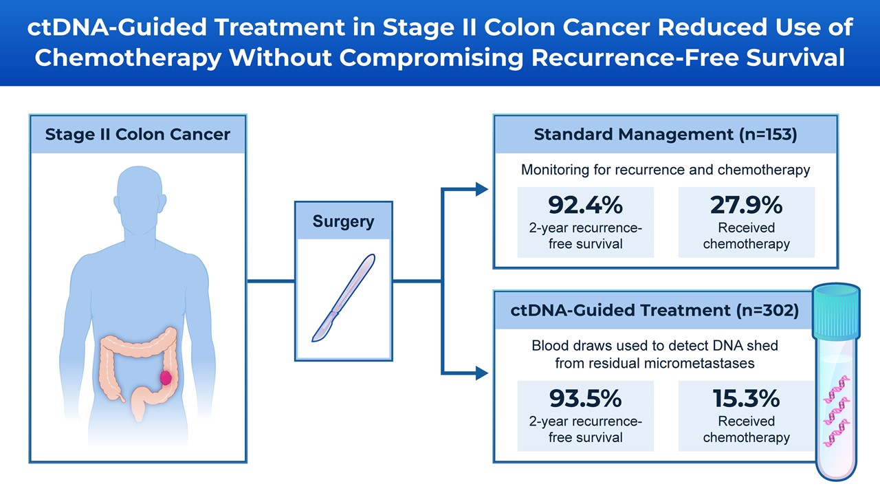 colon cancer graphic